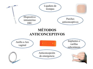 Ligadura de
                            trompas


       Dispositivo
       intrauterino                         Parches
           DIU                          anticonceptivos


                   MÉTODOS
               ANTICONCEPTIVOS

Anillo o Aro                                 Implantes o
  vaginal                                      varillas
                                             subcutáneas

                      Anticoncepción
                      de emergencia
 