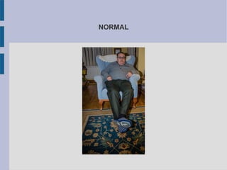 NORMAL