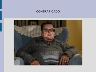 CONTRAPICADO