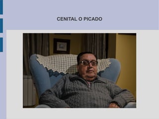 CENITAL O PICADO
 