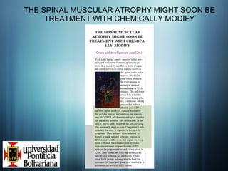 THE SPINAL MUSCULAR ATROPHY MIGHT SOON BE TREATMENT WITH CHEMICALLY MODIFY 