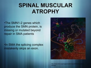 SPINAL MUSCULAR ATROPHY http://www.hhmi.org/images/bulletin/sept2005/structural_detail.jpg The SMN1-2 genes which produce the SMN protein, is missing or mutated beyond repair in SMA patients In SMA the splicing complex mistakenly skips an exon. 
