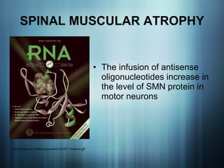 SPINAL MUSCULAR ATROPHY The infusion of antisense oligonucleotides increase in the level of SMN protein in motor neurons  http://rnajournal.cshlp.org/content/12/3/F1.medium.gif 