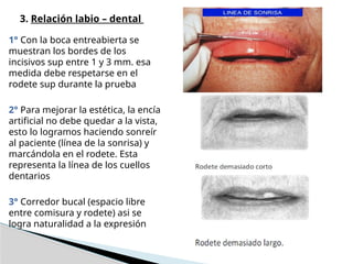 Prótesis Totales - rodetes de mordida sup e inf | PPTX