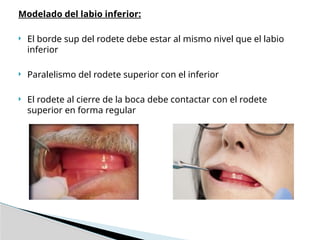 Prótesis Totales - rodetes de mordida sup e inf | PPTX