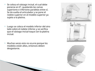 Prótesis Totales - rodetes de mordida sup e inf | PPTX