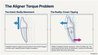 Power Ridgesz How Power Ridges Improve Root Torque in Clear Aligner Treatment | PPTX