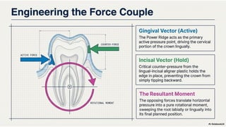 Power Ridgesz How Power Ridges Improve Root Torque in Clear Aligner Treatment | PPTX