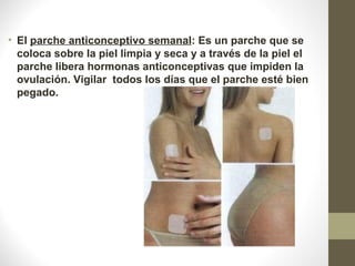 • El parche anticonceptivo semanal: Es un parche que se 
coloca sobre la piel limpia y seca y a través de la piel el 
parche libera hormonas anticonceptivas que impiden la 
ovulación. Vigilar  todos los días que el parche esté bien 
pegado.
 