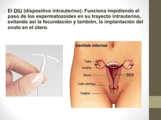 • El DIU (dispositivo intrauterino): Funciona impidiendo el 
paso de los espermatozoides en su trayecto intrauterino, 
evitando así la fecundación y también, la implantación del 
ovulo en el útero.
 