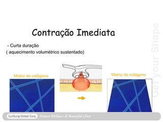 Get
your
Shape
Contração Imediata
- Curta duração
( aquecimento volumétrico sustentado)
Matriz de colágeno Matriz de colágeno
 