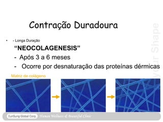 Get
your
Shape
Contração Duradoura
• - Longa Duração
“NEOCOLAGENESIS”
- Após 3 a 6 meses
- Ocorre por desnaturação das proteínas dérmicas
Matriz de colágeno
 