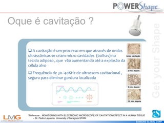 Get
your
Shape
EUNSUNG GLOBAL CORP.
 A cavitação é um processo em que através de ondas
ultrassônicas se criam micro cavidades (bolhas) no
tecido adiposo , que vão aumentando até a explosão da
célula alvo
 Frequência de 30~40KHz de ultrassom cavitacional ,
segura para eliminar gordura localizada
*Reference : MONITORING WITH ELECTRONIC MICROSCOPE OF CAVITATION EFFECT IN A HUMAN TISSUE
– Dr. Pedro Lapuente University of Saragoza SPAIN
Oque é cavitação ?
Antes cavitação
2 min. depois
5 min. depois
10 min. depois
Get
your
Shape
 