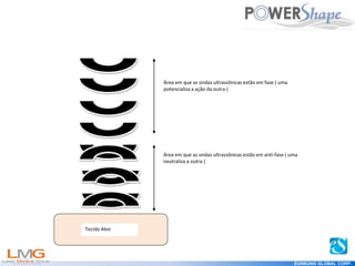Get
your
Shape
EUNSUNG GLOBAL CORP.
Área em que as ondas ultrassônicas estão em fase ( uma
potencializa a ação da outra )
Área em que as ondas ultrassônicas estão em anti-fase ( uma
neutraliza a outra )
Tecido Alvo
 