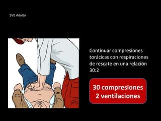 SVB Adulto
Continuar compresiones
torácicas con respiraciones
de rescate en una relación
30:2
30 compresiones
2 ventilaciones
 