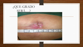 ¿QUE GRADO
SERÁ….?
 