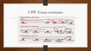 UPP. Zonas comunes
 