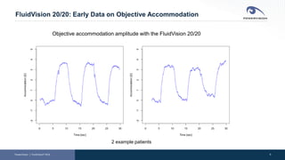 9
FluidVision 20/20: Early Data on Objective Accommodation
PowerVision │ FluidVision® AIOL
Objective accommodation amplitude with the FluidVision 20/20
2 example patients
 