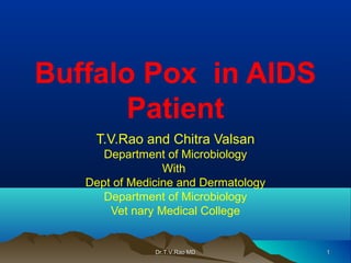 Buffalo Pox in AIDS
Patient
T.V.Rao and Chitra Valsan
Department of Microbiology
With
Dept of Medicine and Dermatology
Department of Microbiology
Vet nary Medical College
Dr.T.V.Rao MDDr.T.V.Rao MD 11
 