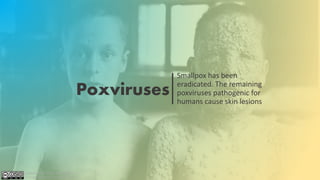 Poxviruses
Smallpox has been
eradicated. The remaining
poxviruses pathogenic for
humans cause skin lesions
Attribution-NonCommercial-ShareAlike
4.0 International (CC BY-NC-SA 4.0)
 