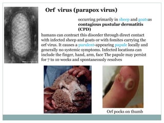 Orf  virus (parapox virus) occurring primarily in  sheep  and  goats as  contagious pustular dermatitis (CPD) humans can contract this disorder through direct contact with infected sheep and goats or with fomites carrying the orf virus. It causes a  purulent -appearing  papule  locally and generally no systemic symptoms. Infected locations can include the finger, hand, arm, face The papule may persist for 7 to 10 weeks and spontaneously resolves Orf pocks on thumb 