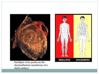 Smallpox virus pocks on the chorioallantoic membrane of a chick embryo 