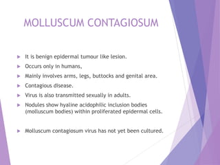 MOLLUSCUM CONTAGIOSUM
 It is benign epidermal tumour like lesion.
 Occurs only in humans,
 Mainly involves arms, legs, buttocks and genital area.
 Contagious disease.
 Virus is also transmitted sexually in adults.
 Nodules show hyaline acidophilic inclusion bodies
(molluscum bodies) within proliferated epidermal cells.
 Molluscum contagiosum virus has not yet been cultured.
 