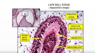 Stella Reticulum Tooth development 2 | PPTX