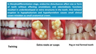 Undeveloped Roots Tooth development 2 | PPTX