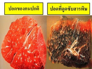 ปอดที่ดูดซับสารพิษ
15 May 2013 16
 
