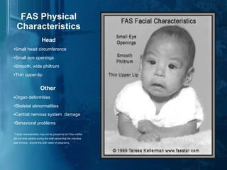 FAS Physical Characteristics Head Small head circumference Small eye openings Smooth, wide philtrum Thin upper-lip Other   Organ deformities Skeletal abnormalities Central nervous system  damage Behavioral problems * Facial characteristics may not be present at all if the mother did not drink alcohol during the brief period that the mid-face was forming - around the 20th week of pregnancy. 