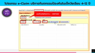 TREYresearch
13
โปรแกรม e-Claim บริการทันตกรรมป้องกันในเด็กวัยเรียน 4-12 ปี
หน้า
F 3 บันทึกรหัสหัตถการ = 2387030
 