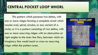 Center Pocket Loop FORENSIC-2- FINGERRINT IDENTIFICATION POWER POINT PRESENTATION | PPTX