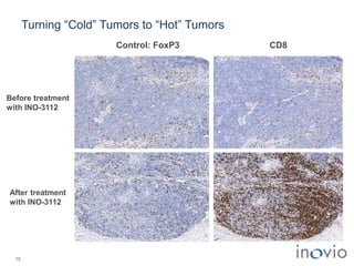 15
Turning “Cold” Tumors to “Hot” Tumors
Before treatment
with INO-3112
After treatment
with INO-3112
Control: FoxP3 CD8
 