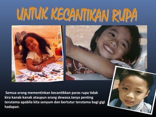 Semua orang mementinkan kecantikkan paras rupa tidak
kira kanak-kanak ataupun orang dewasa.Ianya penting
terutama apabila kita senyum dan bertutur terutama bagi gigi
hadapan.
 