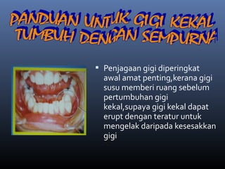  Penjagaan gigi diperingkat
               awal amat penting,kerana gigi
               susu memberi ruang sebelum
Gambar
file m/s 3
               pertumbuhan gigi
               kekal,supaya gigi kekal dapat
               erupt dengan teratur untuk
               mengelak daripada kesesakkan
               gigi
 