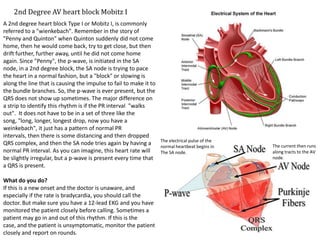 2nd Degree AV heart block Mobitz I
A 2nd degree heart block Type I or Mobitz I, is commonly
referred to a "wienkebach". Remember in the story of
"Penny and Quinton" when Quinton suddenly did not come
home, then he would come back, try to get close, but then
drift further, further away, until he did not come home
again. Since "Penny", the p-wave, is initiated in the SA
node, in a 2nd degree block, the SA node is trying to pace
the heart in a normal fashion, but a "block" or slowing is
along the line that is causing the impulse to fail to make it to
the bundle branches. So, the p-wave is ever present, but the
QRS does not show up sometimes. The major difference on
a strip to identify this rhythm is if the PR interval "walks
out". It does not have to be in a set of three like the
song, "long, longer, longest drop, now you have a
weinkebach", it just has a pattern of normal PR
intervals, then there is some distancing and then dropped
                                                                   The electrical pulse of the
QRS complex, and then the SA node tries again by having a          normal heartbeat begins in    The current then runs
normal PR interval. As you can imagine, this heart rate will       The SA node.                  along tracts to the AV
be slightly irregular, but a p-wave is present every time that                                   node.
a QRS is present.

What do you do?
If this is a new onset and the doctor is unaware, and
especially if the rate is bradycardia, you should call the
doctor. But make sure you have a 12-lead EKG and you have
monitored the patient closely before calling. Sometimes a
patient may go in and out of this rhythm. If this is the
case, and the patient is unsymptomatic, monitor the patient
closely and report on rounds.
 