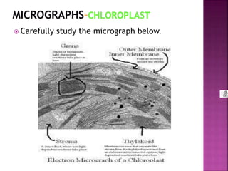  Carefully study the micrograph below.
 