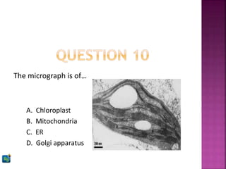 The micrograph is of…
A. Chloroplast
B. Mitochondria
C. ER
D. Golgi apparatus
 