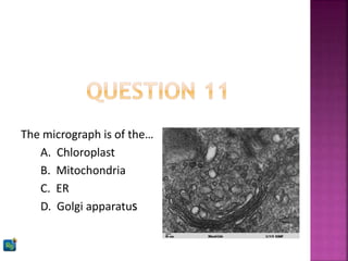 The micrograph is of the…
A. Chloroplast
B. Mitochondria
C. ER
D. Golgi apparatus
 