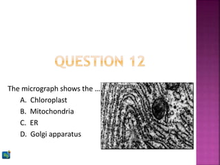 The micrograph shows the …
A. Chloroplast
B. Mitochondria
C. ER
D. Golgi apparatus
 