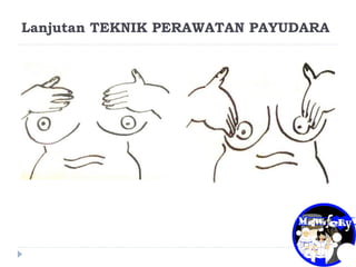 Lanjutan TEKNIK PERAWATAN PAYUDARA
 