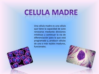 CELULA MADRE  Una célula madre es una célula que tiene la capacidad de auto renovarse mediante divisiones mitóticas y continuar la vía de diferenciación para la que está programada y, producir células de uno o más tejidos maduros, funcionales.  