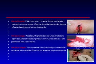 •

Heridas Punzantes: Están producidas por la acción de objectos alargados y

•

puntiagudos. (punzón, agujas...) Este tipo de heridas tienen un alto riesgo de

•

infección dependiendo de la profundidad de ella

•
•
•

Heridas en colgajo: Presentan un fragmento de la piel unido al resto de la

•

superficie cutánea a través de un pendiculo. Son muy frecuentes en la cara

•

posterior del codo y de la rodilla.

•
•

Heridas por desgarro: Son muy severas y son producidas por un mecanismo

•

de tracción sobre los tejidos. Suelen ser por atropellos, maquinas industriales..

•
•
•

 