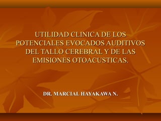 UTILIDAD CLINICA DE LOSUTILIDAD CLINICA DE LOS
POTENCIALES EVOCADOS AUDITIVOSPOTENCIALES EVOCADOS AUDITIVOS
DEL TALLO CEREBRAL Y DE LASDEL TALLO CEREBRAL Y DE LAS
EMISIONES OTOACUSTICAS.EMISIONES OTOACUSTICAS.
DR. MARCIAL HAYAKAWA N.DR. MARCIAL HAYAKAWA N.
 