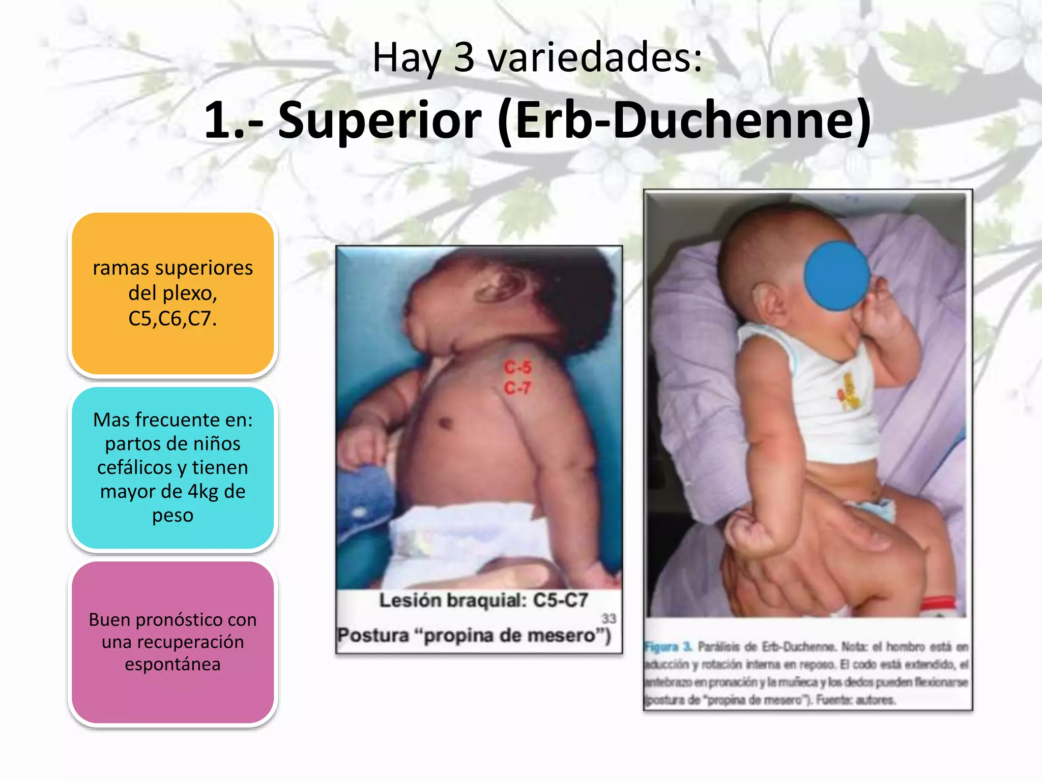 PARÁLISIS DEL PLEXO BRAQUIAL- NEONATOLOGÍA | PPTX