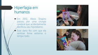 Hiperfagia em
humanos
 Em 2012, Alexis Shapiro
passou por uma cirurgia
cerebral que acidentalmente
danificou seu hipotálamo.
 Esse dano fez com que ela
sentisse fome extrema o
tempo todo.
 