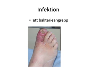 Infektion
= ett bakterieangrepp
 