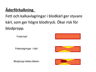 Åderförkalkning
Fett och kalkavlagringar i blodkärl ger styvare
kärl, som ger högre blodtryck. Ökar risk för
blodpropp.
       Friskt kärl




      Fettavlagringar i kärl




     Blodpropp bildas lättare .
 