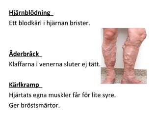 Hjärnblödning
Ett blodkärl i hjärnan brister.



Åderbråck
Klaffarna i venerna sluter ej tätt.

Kärlkramp
Hjärtats egna muskler får för lite syre.
Ger bröstsmärtor.
 